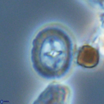 Prediscosphaera spinosa 33439