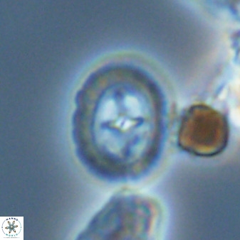 Prediscosphaera spinosa 33439