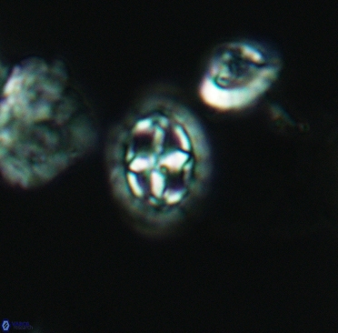 Prediscosphaera spinosa 3369