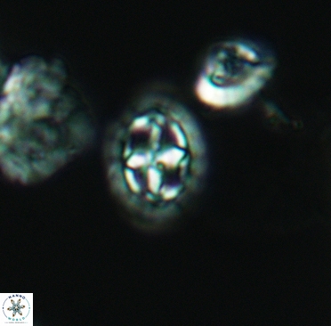 Prediscosphaera spinosa 3369