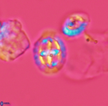 Prediscosphaera spinosa 3370
