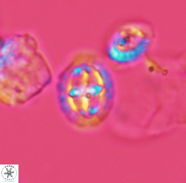 Prediscosphaera spinosa 3370