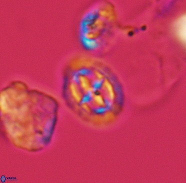 Prediscosphaera spinosa 3371