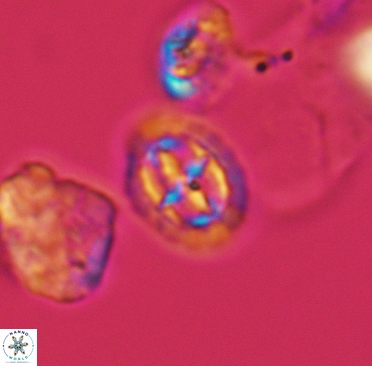 Prediscosphaera spinosa 3371
