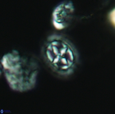 Prediscosphaera spinosa 3372