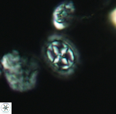 Prediscosphaera spinosa 3372