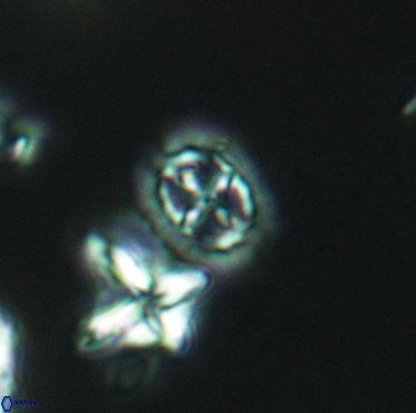 Prediscosphaera spinosa 3396