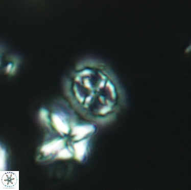 Prediscosphaera spinosa 3396