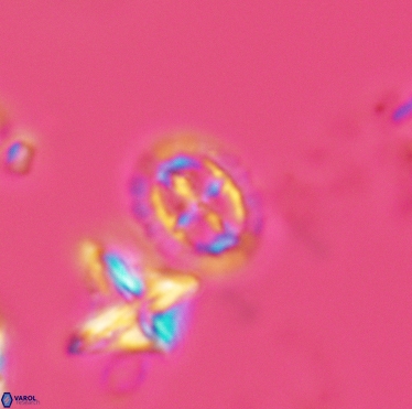 Prediscosphaera spinosa 3397