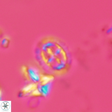 Prediscosphaera spinosa 3397
