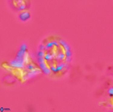 Prediscosphaera spinosa 3398