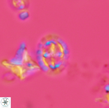 Prediscosphaera spinosa 3398