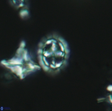 Prediscosphaera spinosa 3399