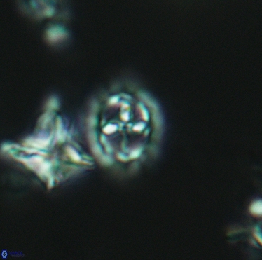 Prediscosphaera spinosa 3400