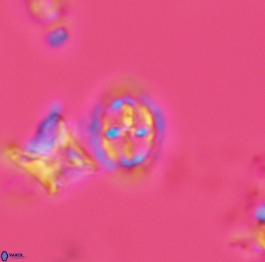Prediscosphaera spinosa 3401