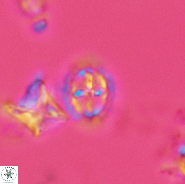 Prediscosphaera spinosa 3401