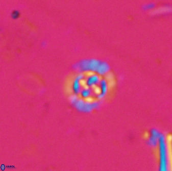 Prediscosphaera spinosa 35727