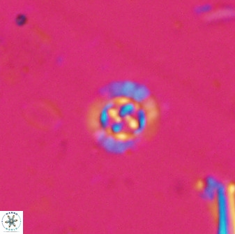 Prediscosphaera spinosa 35727