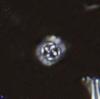 Prediscosphaera spinosa 35728