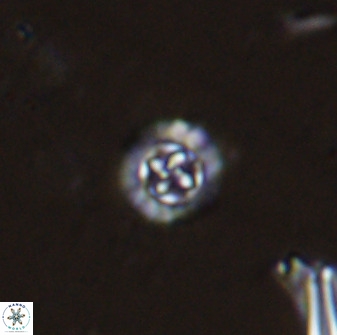 Prediscosphaera spinosa 35728