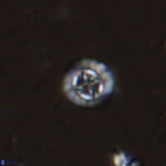 Prediscosphaera spinosa 35729