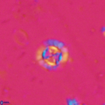 Prediscosphaera spinosa 35730