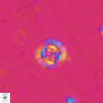Prediscosphaera spinosa 35730