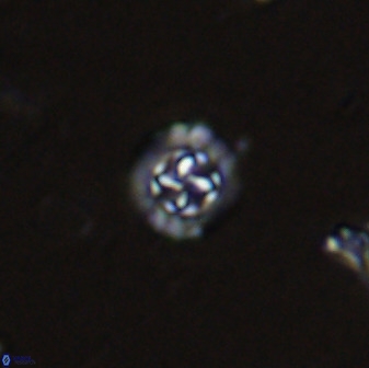 Prediscosphaera spinosa 35731