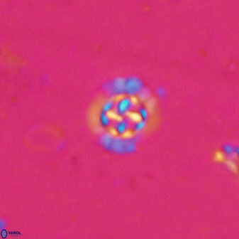 Prediscosphaera spinosa 35732