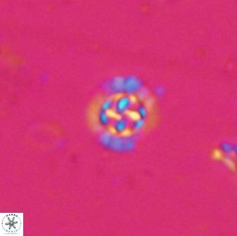 Prediscosphaera spinosa 35732