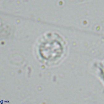 Prediscosphaera spinosa 35733