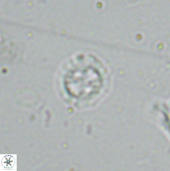 Prediscosphaera spinosa 35733