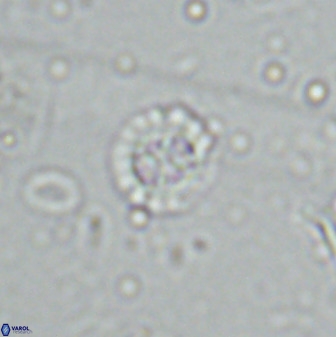 Prediscosphaera spinosa 35734