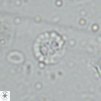 Prediscosphaera spinosa 35734