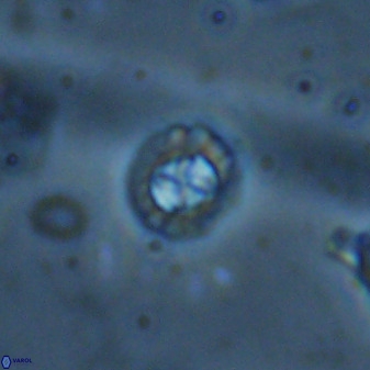 Prediscosphaera spinosa 35735