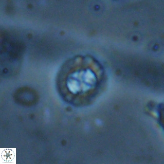 Prediscosphaera spinosa 35735