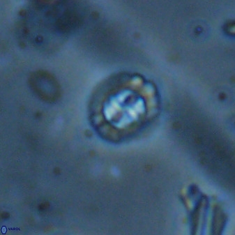 Prediscosphaera spinosa 35736