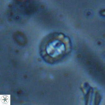 Prediscosphaera spinosa 35736