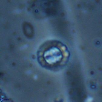 Prediscosphaera spinosa 35737