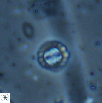 Prediscosphaera spinosa 35737