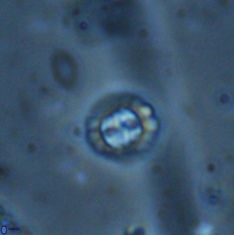 Prediscosphaera spinosa 35738