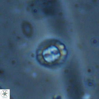 Prediscosphaera spinosa 35738