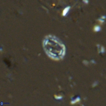 Prediscosphaera spinosa VR 14710