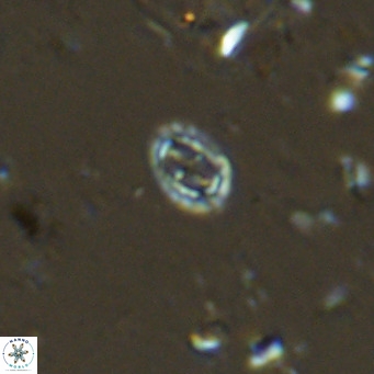 Prediscosphaera spinosa VR 14710