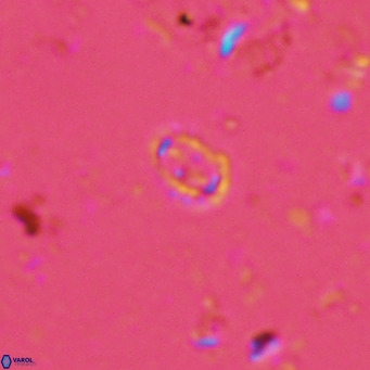 Prediscosphaera spinosa VR 14711