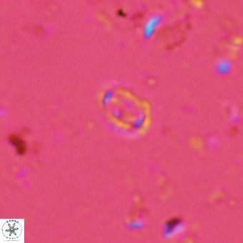 Prediscosphaera spinosa VR 14711