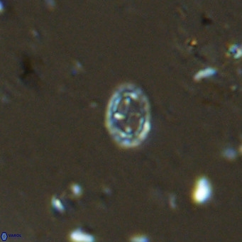 Prediscosphaera spinosa VR 14712