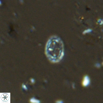 Prediscosphaera spinosa VR 14712