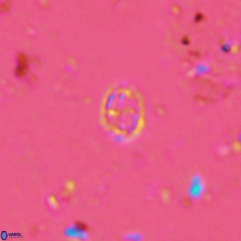 Prediscosphaera spinosa VR 14714