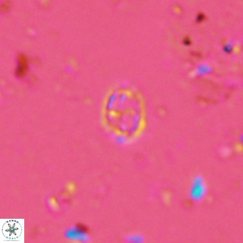 Prediscosphaera spinosa VR 14714